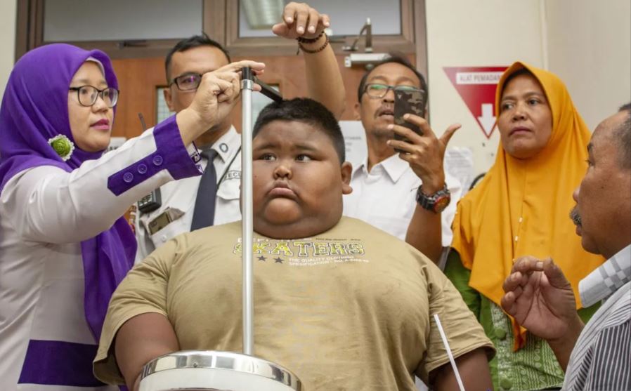 Jangan Sepelekan Obesitas, Berbagai Penyakit Menanti